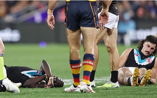 AFL fines Port Adelaide $100,000 over concussion breach